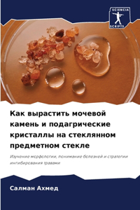 Как вырастить мочевой камень и подагричес