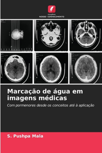 Marcação de água em imagens médicas