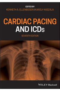 Cardiac Pacing and Icds