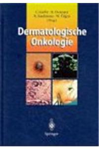 DERMATOLOGISCHE ONKOLOGIE