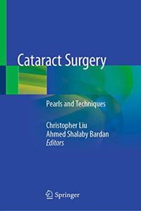 Cataract Surgery