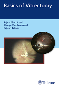 Basics Of Vitrectomy (Hb 2016)