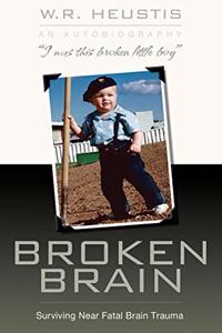 Broken Brain