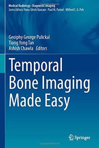 Temporal Bone Imaging Made Easy