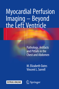 Myocardial Perfusion Imaging - Beyond the Left Ventricle