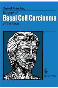 Surgery of Basal Cell Carcinoma of the Face