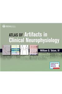 Atlas of Artifacts in Clinical Neurophysiology