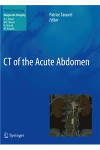 CT of the Acute Abdomen