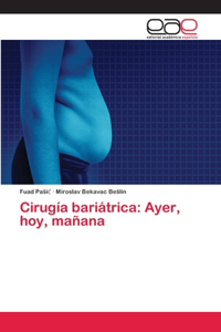 Cirugía bariátrica