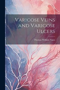 Varicose Veins and Varicose Ulcers