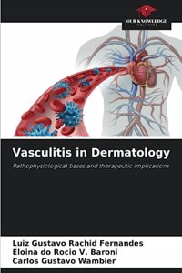 Vasculitis in Dermatology