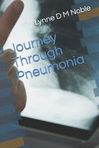 Journey Through Pneumonia