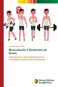 Musculação e Síndrome de Down