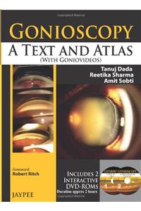 Gonioscopy: A Text and Atlas (with Goniovideos)