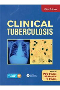 Clinical Tuberculosis