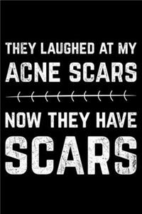 They Laughed At My Acne Scars Now They Have The Scars