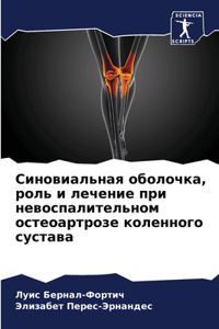 Синовиальная оболочка, роль и лечение при 
