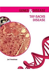 Tay-Sachs Disease