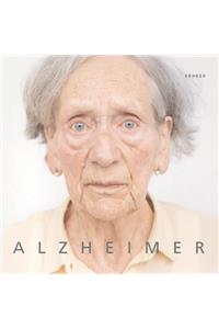 Alzheimer