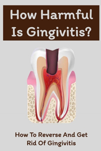How Harmful Is Gingivitis?