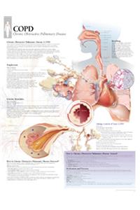 Copd Chart: Wall Chart