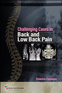 Challenging Cases in Back and Low Back Pain