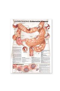 Understanding Colorectal Cancer Anatomical Chart