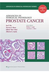 Advances in Surgical Pathology: Prostate Cancer