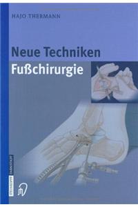 Neue Techniken Fusschirurgie