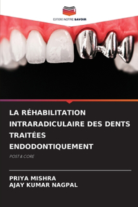 Réhabilitation Intraradiculaire Des Dents Traitées Endodontiquement