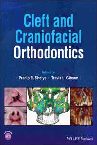 Cleft and Craniofacial Orthodontics