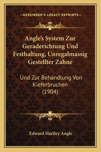 Angle's System Zur Geraderichtung Und Festhaltung, Unregalmassig Gestellter Zahne