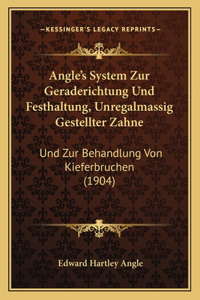 Angle's System Zur Geraderichtung Und Festhaltung, Unregalmassig Gestellter Zahne