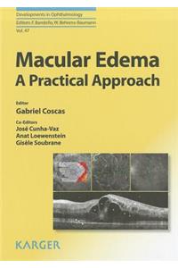 Macular Edema: A Practical Approach
