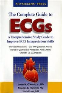 The Complete Guide to Ecgs