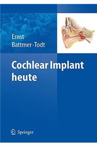 Cochlear Implant Heute