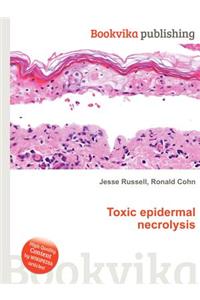 Toxic Epidermal Necrolysis