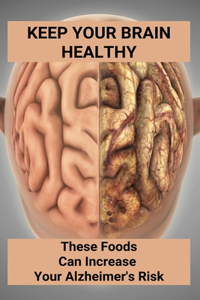 Keep Your Brain Healthy