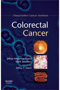 Colorectal Cancer
