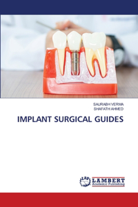 Implant Surgical Guides