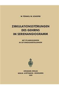 Zirkulationsstörungen Des Gehirns Im Serienangiogramm