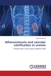 Atherosclerosis and vascular calcification in uremia