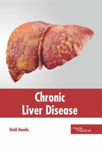 Chronic Liver Disease