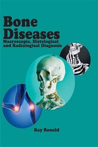 Bone Diseases: Macroscopic, Histological and Radiological Diagnosis: Bone Diseases: Macroscopic, Histological and Radiological Diagnosis