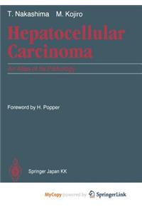 Hepatocellular Carcinoma