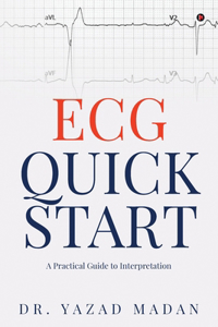 ECG Quick Start