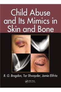 Child Abuse and its Mimics in Skin and Bone