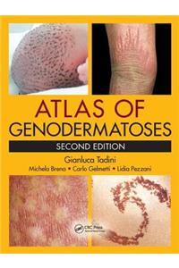 Atlas of Genodermatoses