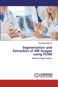 Segmentation and Extraction of MR Images using PCNN