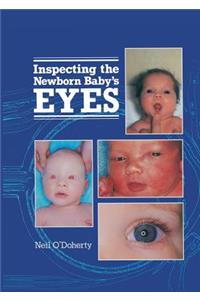Inspecting the Newborn Baby's Eyes